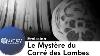The Myst Re Du Carr Des Lombes